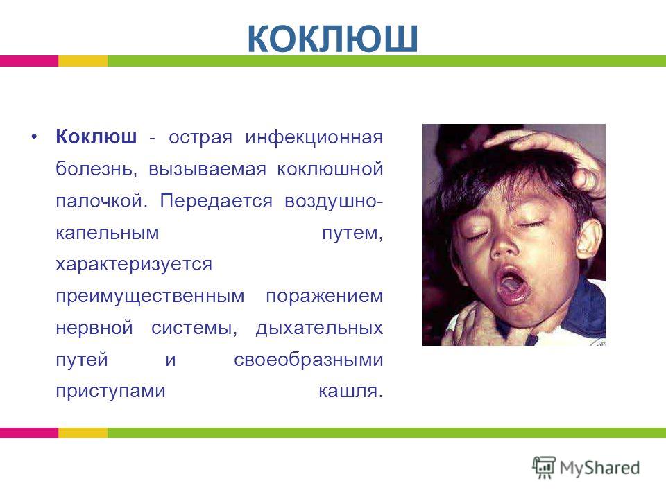 Коклюш кашель днем Коклюш кашель днем