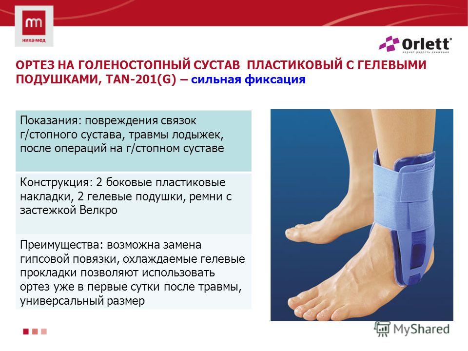 Травма голеностопного сустава кто Травма голеностопного сустава кто