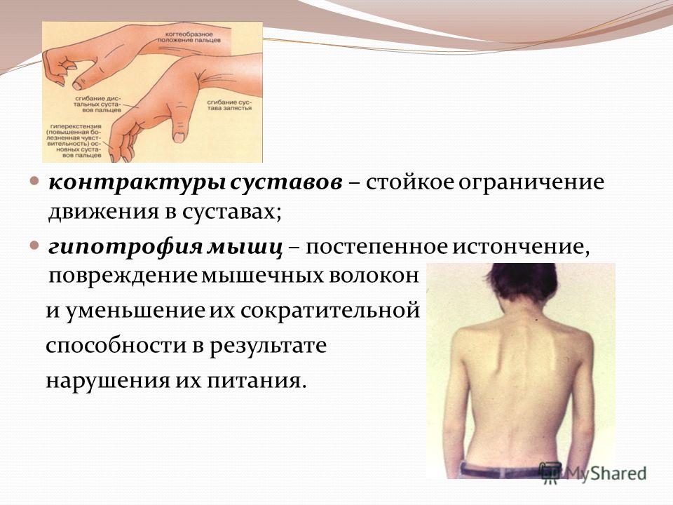 Шишонин гимнастика для шеи ютуб Шишонин гимнастика для шеи ютуб