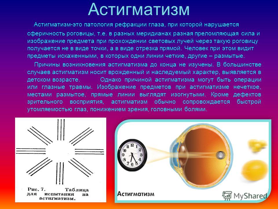 Гимнастика для глаз при астигматизм