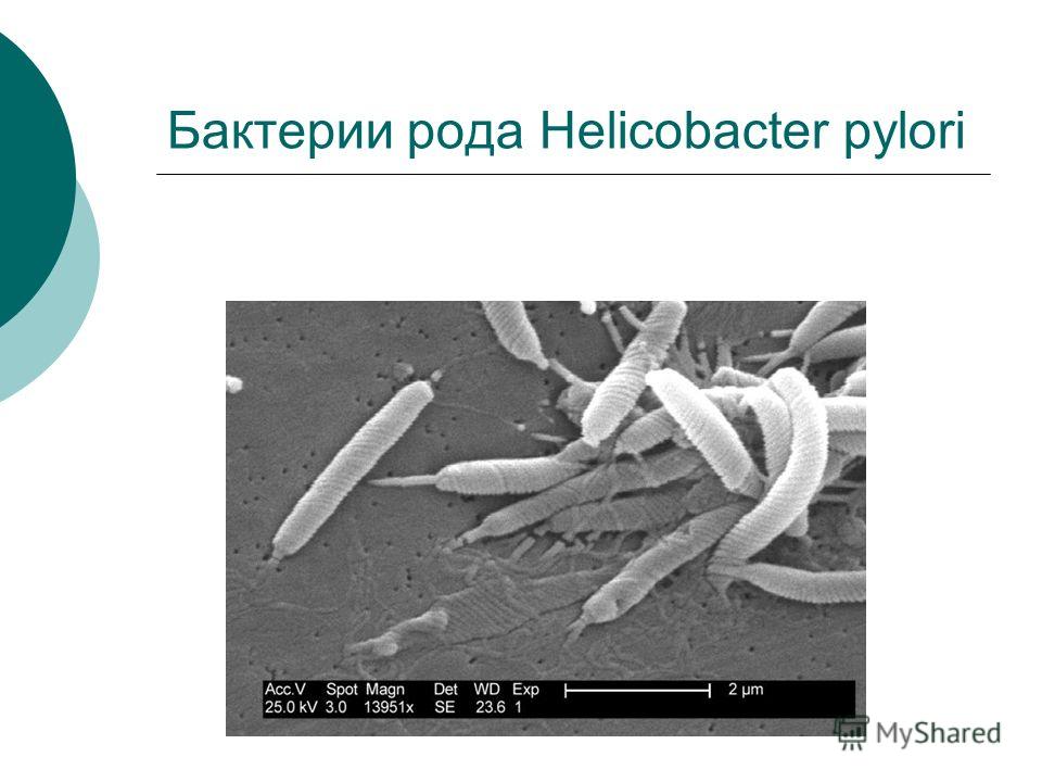 Mi marido tiene helicobacter pylori