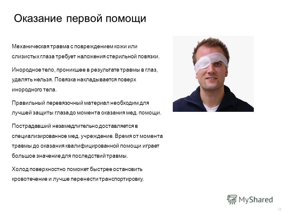 Как выглядит травма глаза Первая Помощь При Поражении Органов Зрения - 72 фото