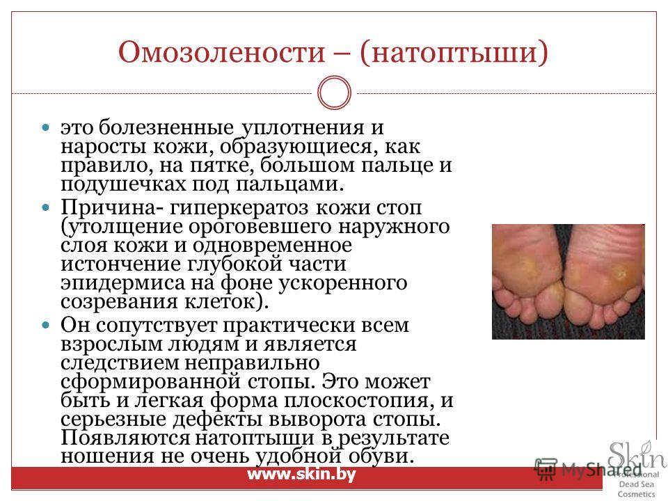 Декупаж стульев своими руками фото: как декорировать старый Вязаные крючком коврики на пол - имидж вашего дома