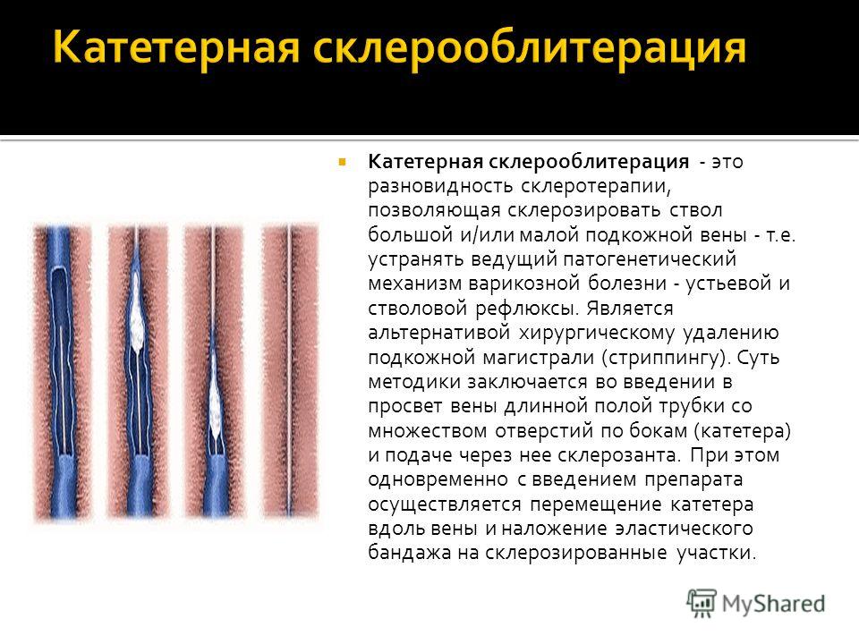 без хирургическое увеличение груди без хирургическое увеличение груди