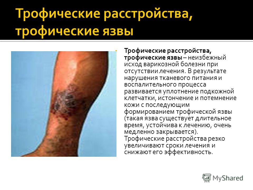 Как лечит кожу потемневшую от трофической язвы Как лечит кожу потемневшую от трофической язвы