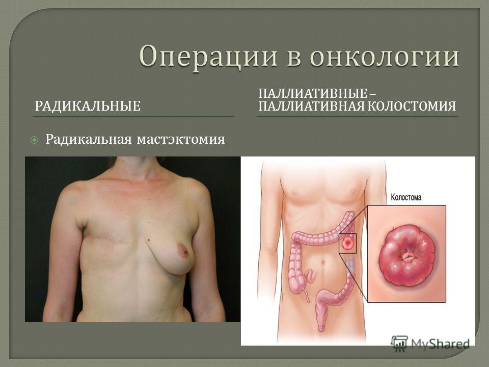 без хирургическое увеличение груди без хирургическое увеличение груди