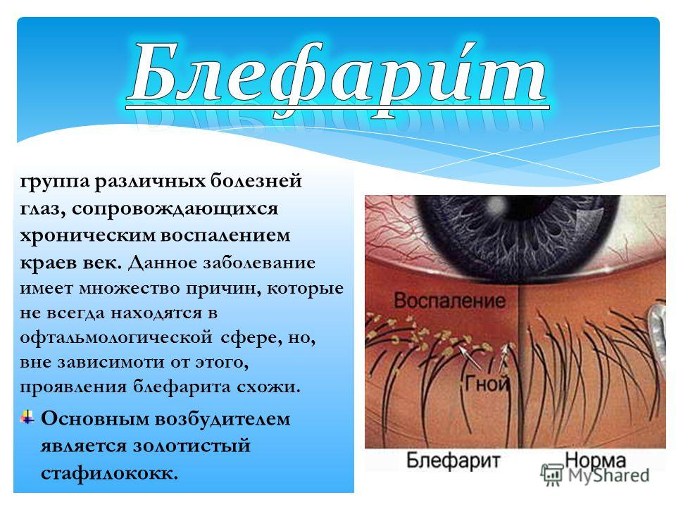 Реферат: Болезни глаза этиология и лечение