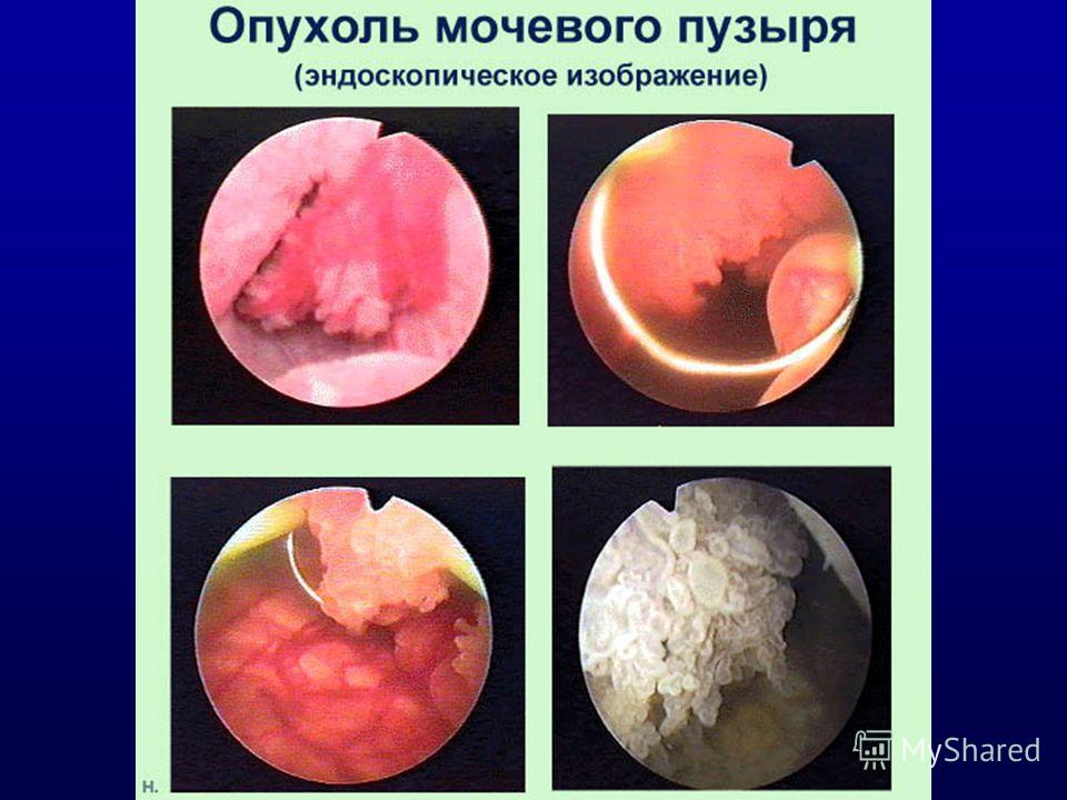 181 поликлиника в строгино вызов врача