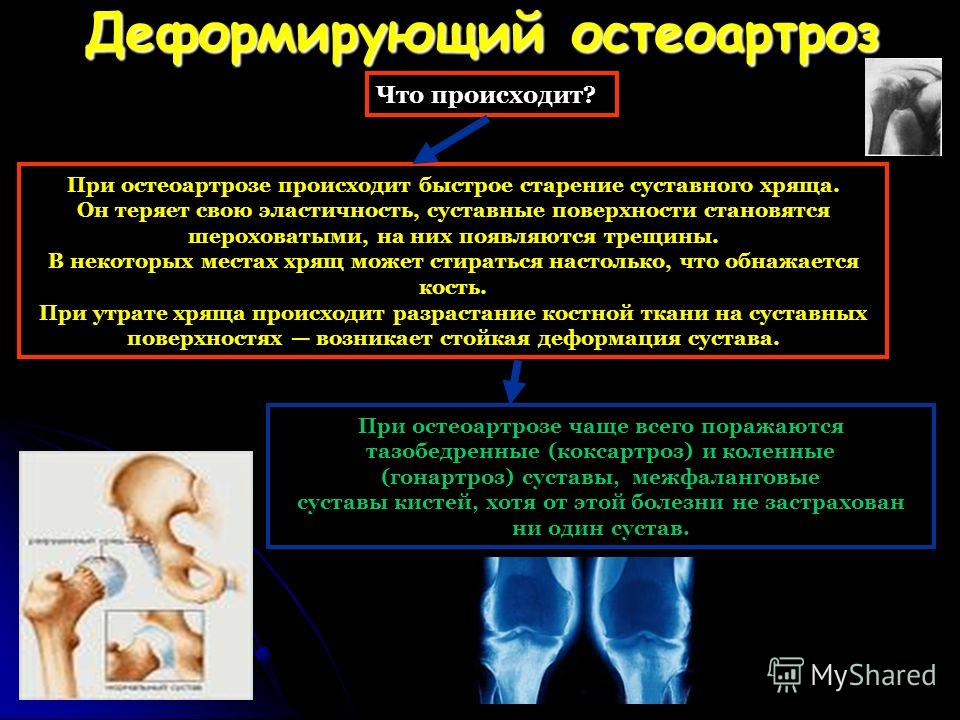 Болит плечо больно поднимать руку