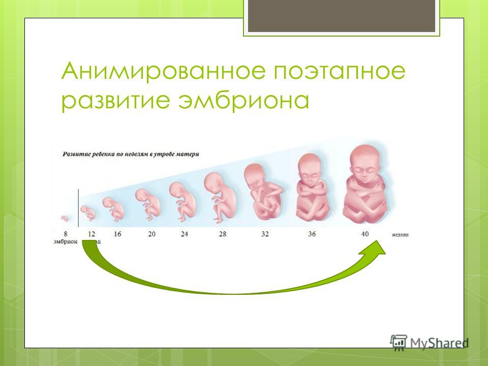 Поэтапное развитие это Поэтапное развитие это