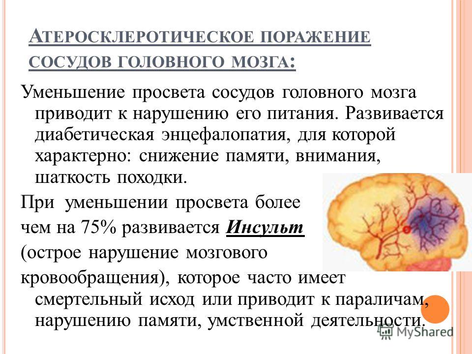 Диета При Ишемической Болезни Головного Мозга