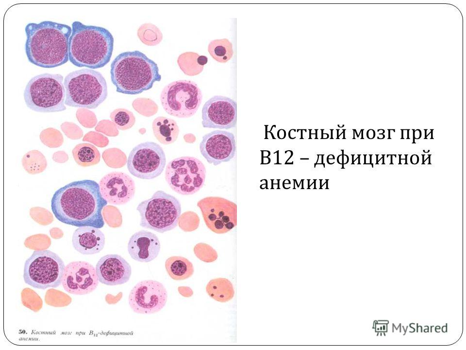 Костный мозг связан с Костный мозг связан с