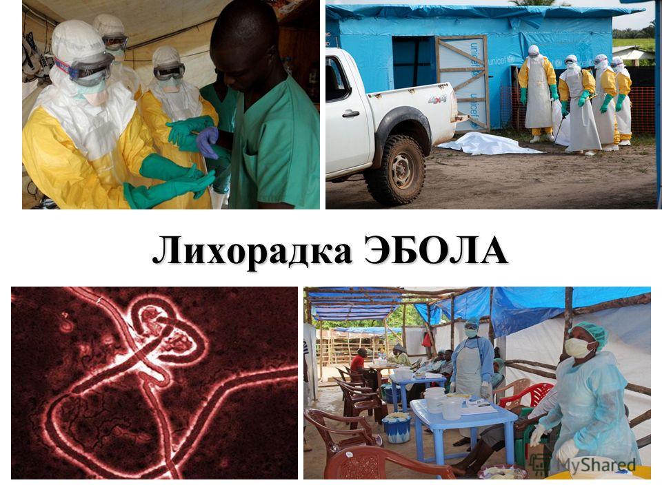 При месячных сильная боль в заднем проходе