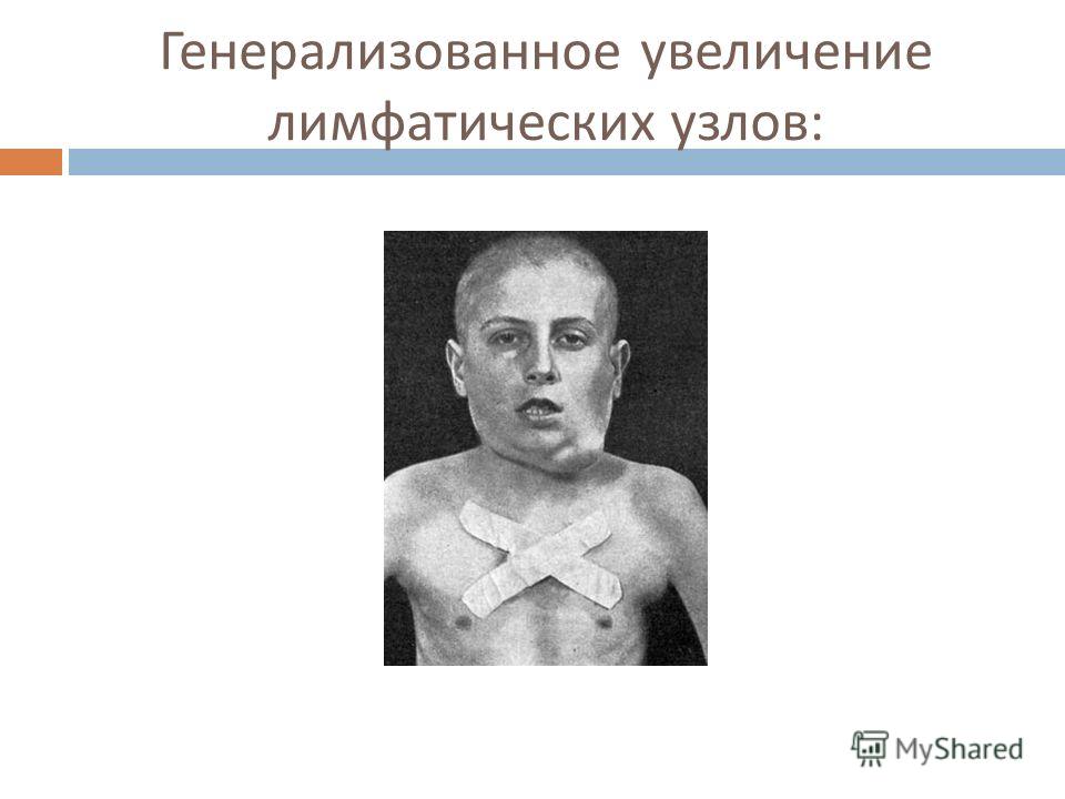 летучие летучие