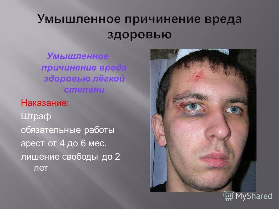 умышленное причинение легкого вреда здоровью это спрошу твоей