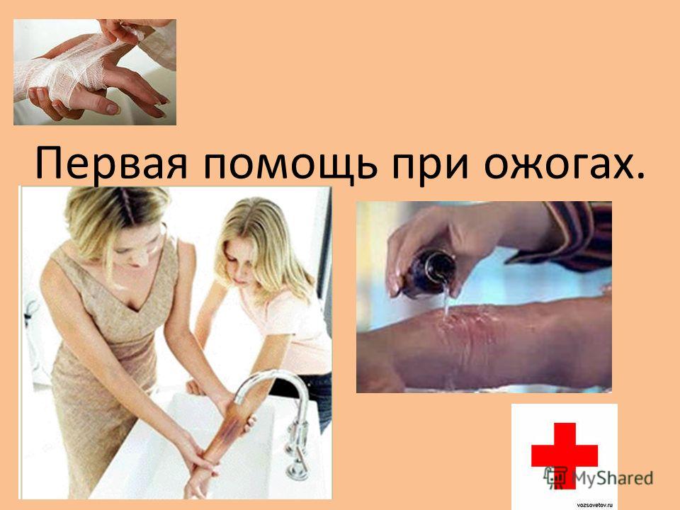 Ожог кипятком первая помощь в домашних условиях чем снять 44