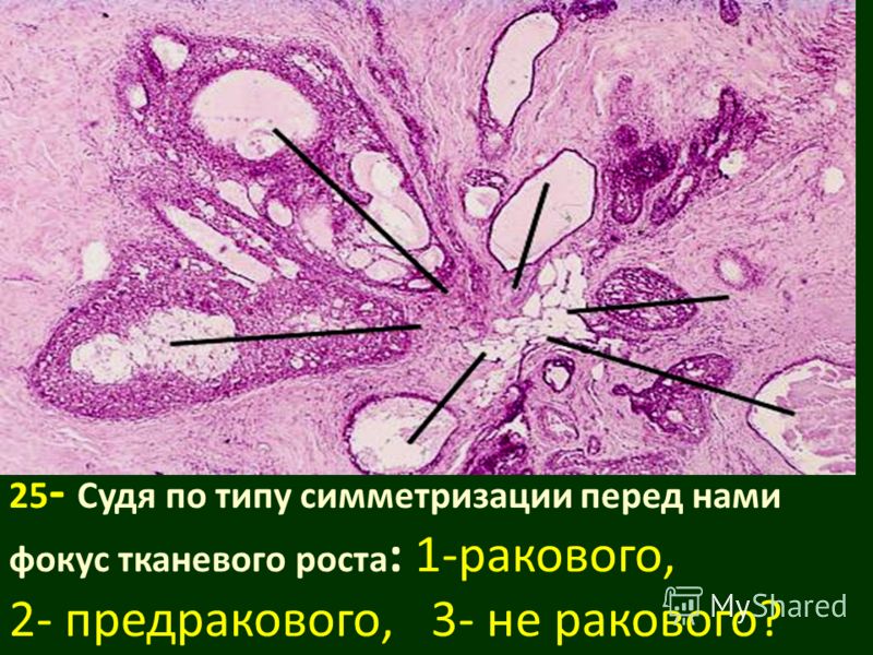 Лечение аденомы простаты и хронического простатита в Кора осины: от какой болезни помогает?