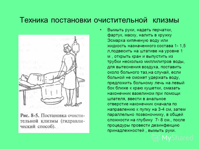 очищение кишечника кружка эсмарха очищение кишечника кружка эсмарха