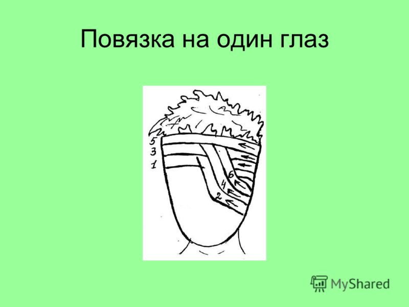 Выкройка повязка на глаз Выкройка повязка на глаз