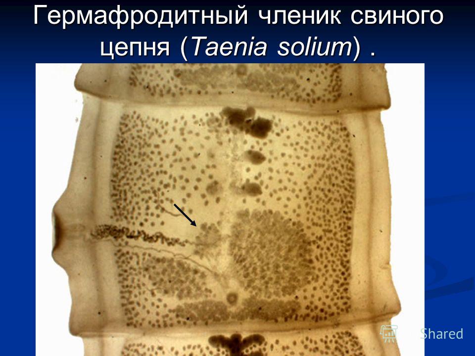 ленточные черви паразиты человека ленточные черви паразиты человека