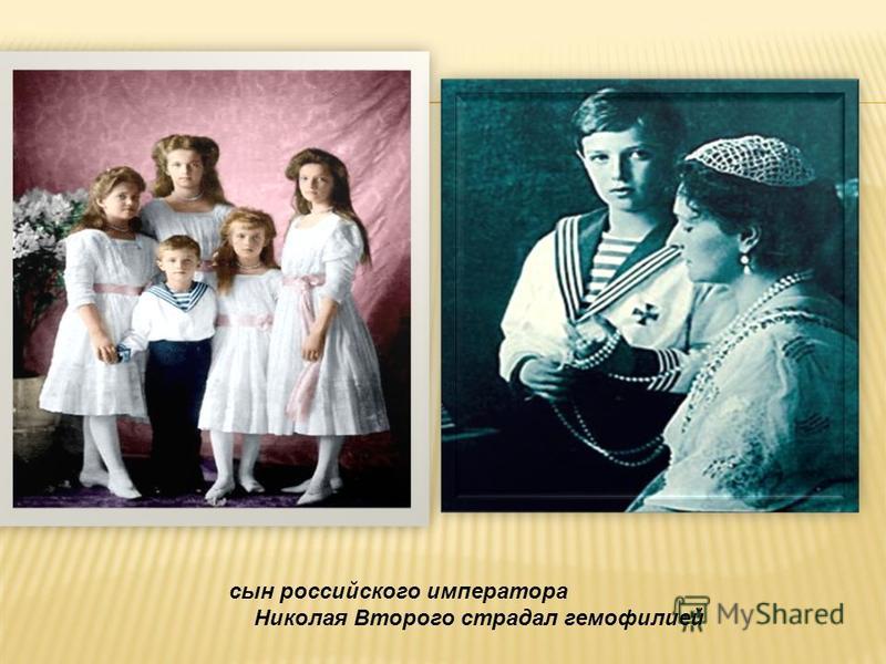 сын российского императора Николая Второго страдал гемофилией