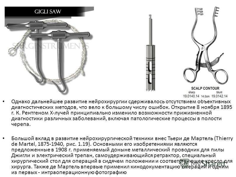 Презентация на тему нейрохирургия