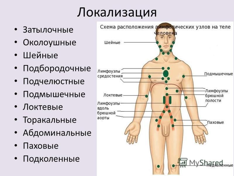 Шейные Лимфатические Узлы Где Находятся Фото