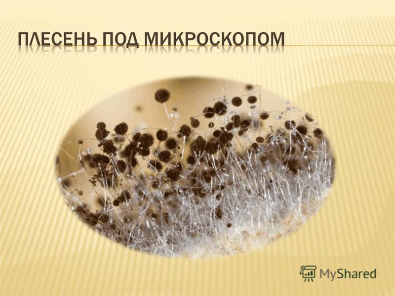 Как выглядит плесень под микроскопом