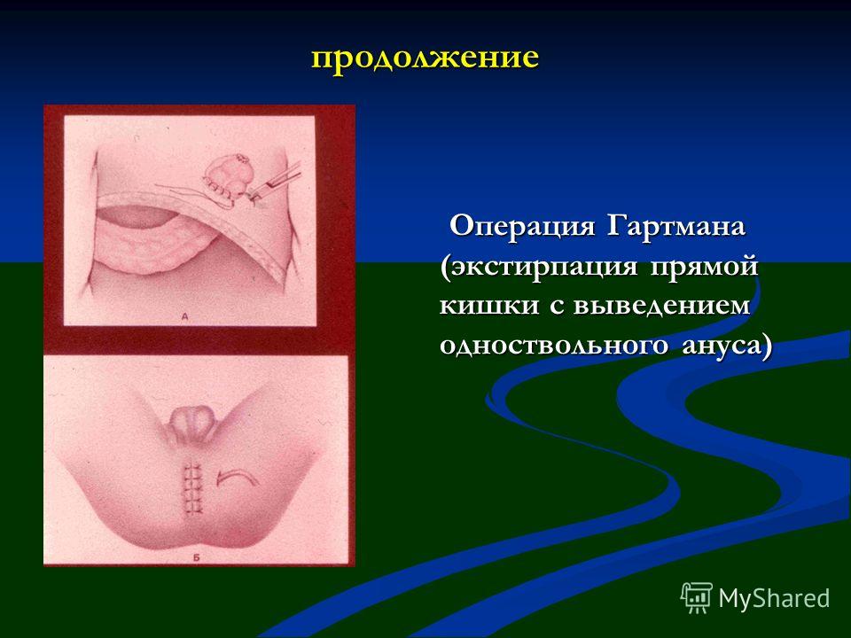 Herpes simplex virus HSV вирус простого герпеса 12 типа